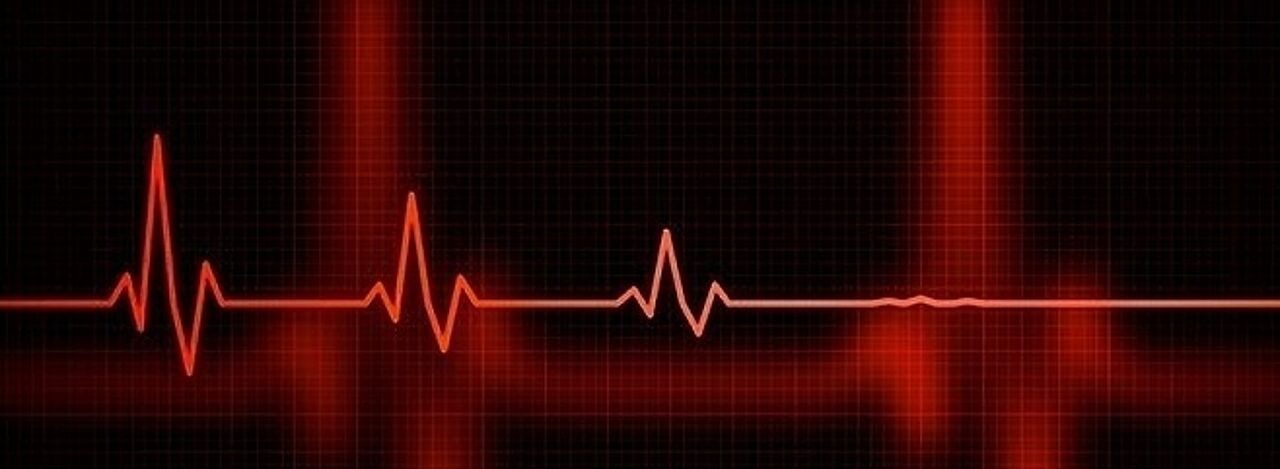 Schwächer werdende EKG Kurve
